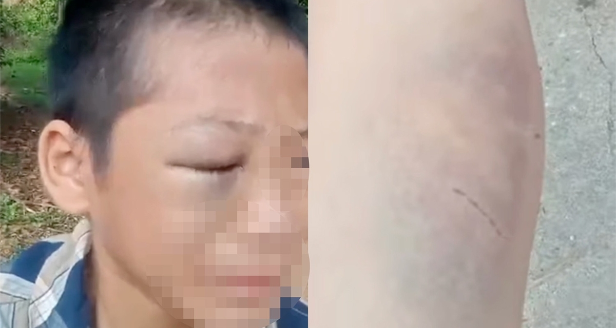 Cơ quan chức năng th&ocirc;ng tin vụ b&eacute; trai lớp 6 cầu cứu v&igrave; bị bố v&agrave; mẹ kế đ&aacute;nh đập, sợ h&atilde;i kh&ocirc;ng d&aacute;m về nh&agrave;