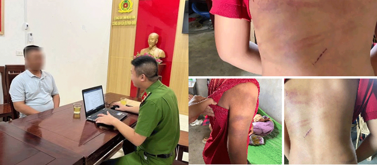 Diễn biến n&oacute;ng vụ mẹ đau đớn c&ocirc;ng khai t&igrave;nh trạng &lsquo;đầy &aacute;m ảnh&rsquo; của con trai nghi bị bố ruột bạo h&agrave;nh