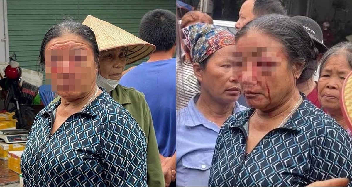 Nguy&ecirc;n nh&acirc;n vụ người b&aacute;n rau bị xịt nước đến chảy m&aacute;u mặt ở Ph&uacute; Thọ, c&ocirc;ng an ch&iacute;nh thức v&agrave;o cuộc