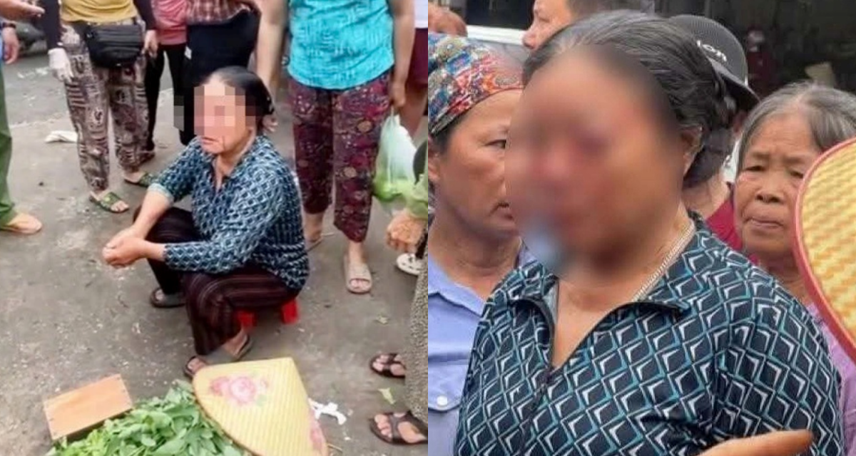 Nh&acirc;n chứng bức x&uacute;c kể lại vụ người phụ nữ b&aacute;n rau bị xịt nước &aacute;p lực cao v&agrave;o mặt, t&igrave;nh h&igrave;nh nạn nh&acirc;n?