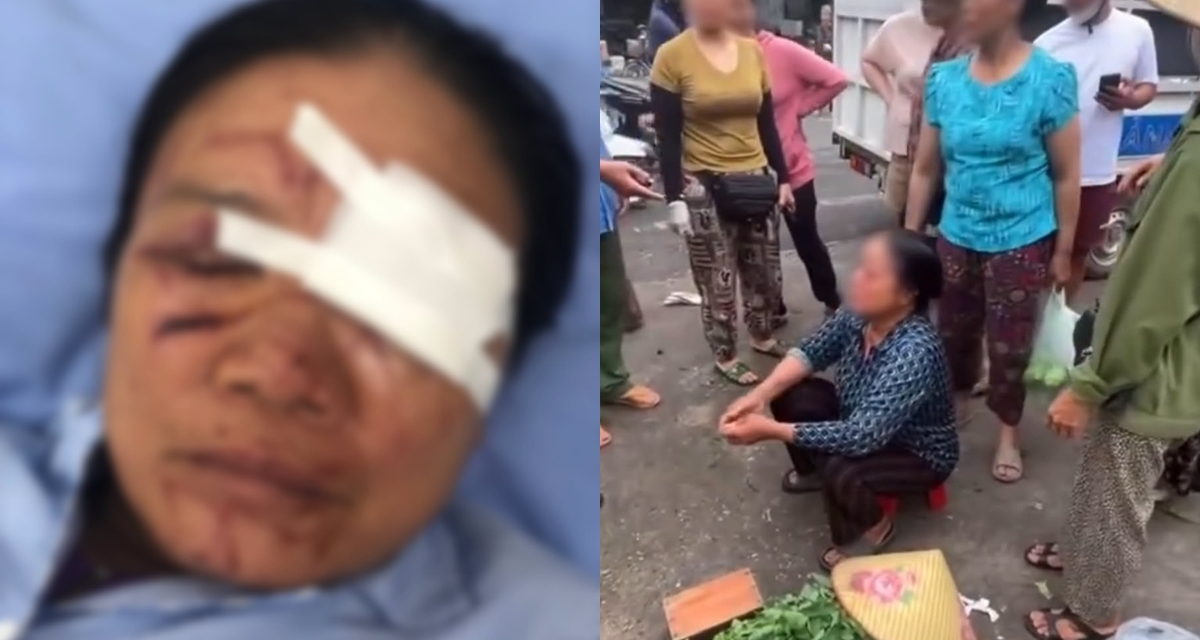 Camera ghi lại nguồn cơn vụ người phụ nữ b&aacute;n rau bị xịt nước đến chảy m&aacute;u mặt, t&igrave;nh h&igrave;nh đ&aacute;ng lo của nạn nh&acirc;n
