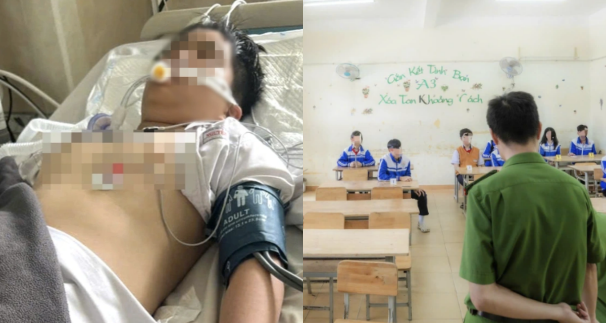 Vụ nam sinh lớp 8 treo cổ vì bị nhóm bạn bắt nạt ở trường: Hé lộ sự việc đau lòng sau khi em tỉnh lại