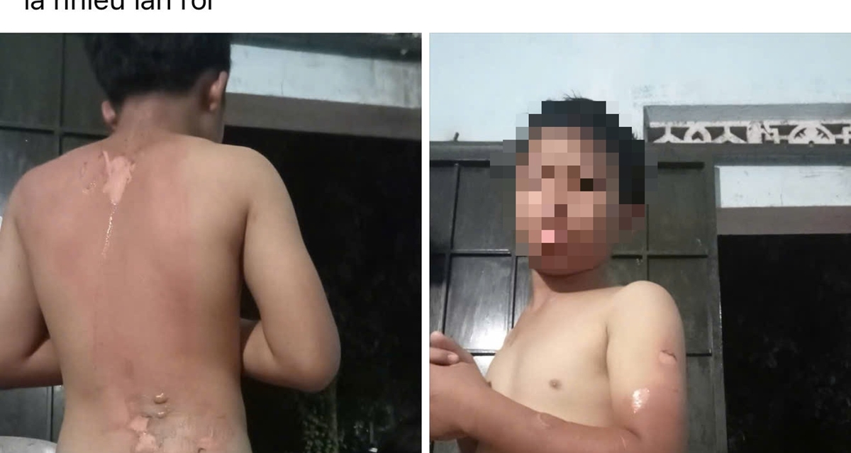 C&ocirc;ng an th&ocirc;ng tin vụ mẹ tạt nước s&ocirc;i l&ecirc;n người khiến con trai bị bỏng ở Đắk Lắk 