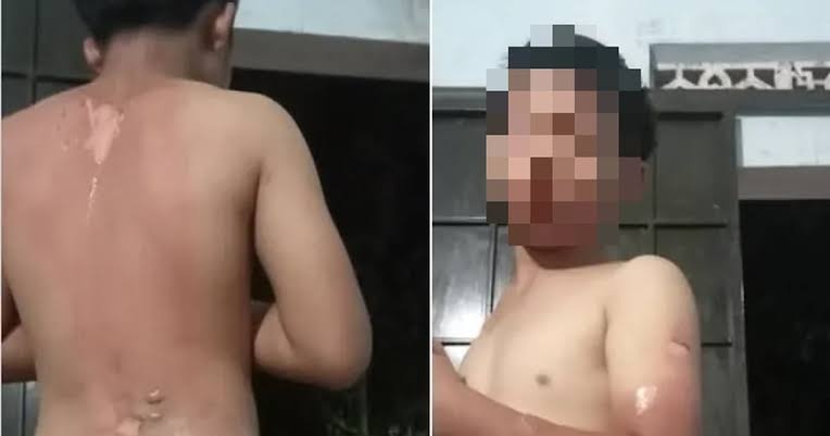 Đắk Lắk: Mẹ ruột thừa nhận tạt nước s&ocirc;i v&agrave;o người con, kể lại l&yacute; do từ chuyện rất nhỏ nhặt