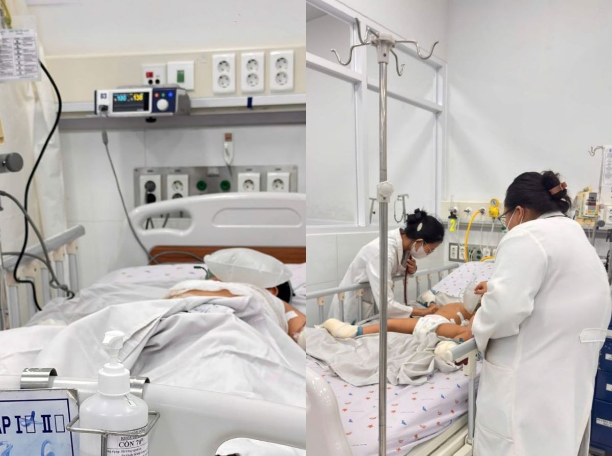 Vụ ch&aacute;y xe kh&aacute;ch l&agrave;m 7 người tử vong ở Đồng Nai: T&igrave;nh h&igrave;nh sức khỏe 2 anh em nhập viện