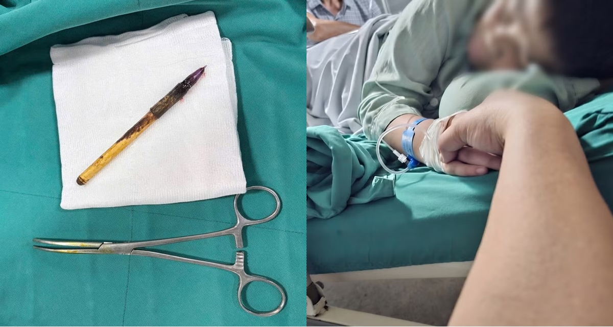 Lời kể đau đớn của b&eacute; trai lớp 6 bị nh&eacute;t b&uacute;t bi v&agrave;o hậu m&ocirc;n, trường v&agrave; c&ocirc; chủ nhiệm phủi sạch tr&aacute;ch nhiệm