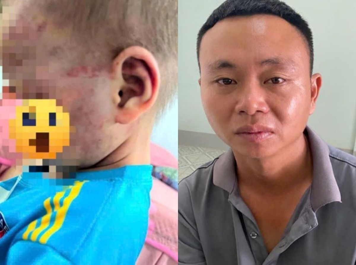 Diễn biến n&oacute;ng vụ cha dượng t&aacute;t, b&oacute;p cổ con ri&ecirc;ng của vợ: Gi&aacute;m đốc C&ocirc;ng an Gia Lai chỉ đạo khẩn