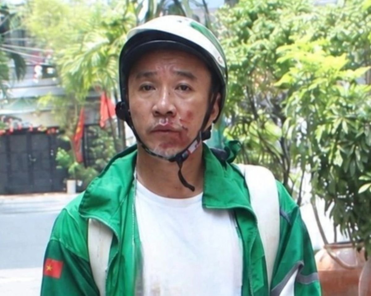 Tin mới vụ giật t&uacute;i x&aacute;ch rồi k&eacute;o l&ecirc; nạn nh&acirc;n giữa đường ở TPHCM, qu&aacute; khứ nhiều tiền &aacute;n g&acirc;y bất ngờ