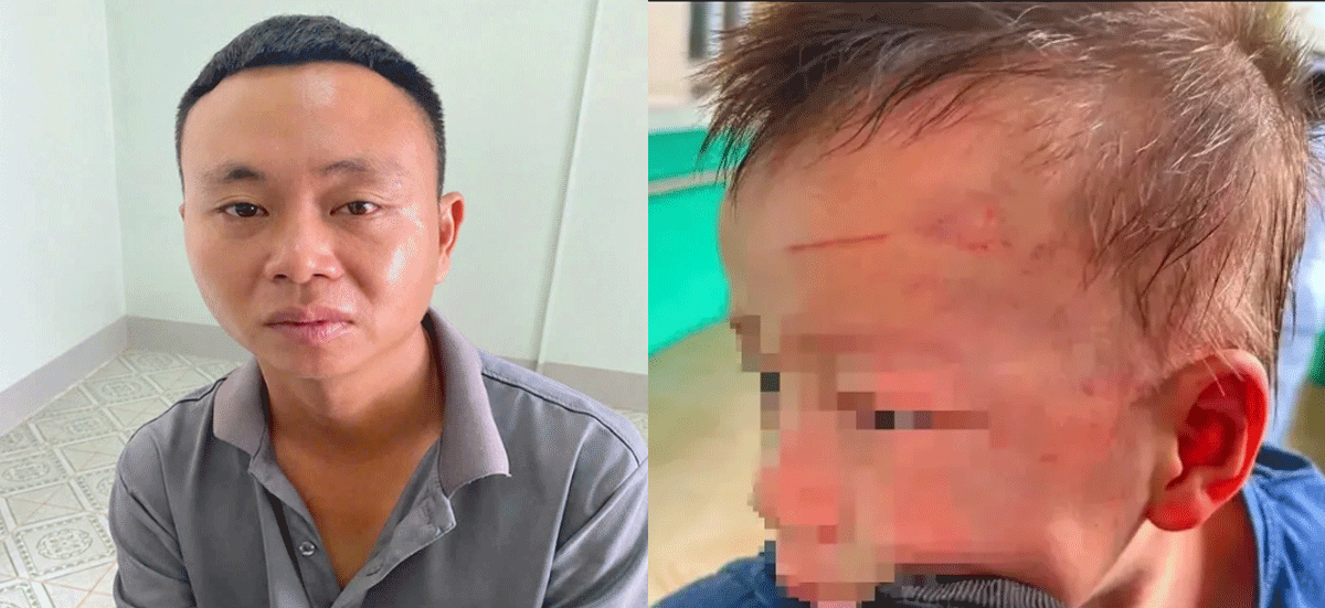 Bắt tạm giam cha dượng bạo h&agrave;nh con ri&ecirc;ng của vợ, phẫn nộ l&yacute; do g&atilde; đ&agrave;n &ocirc;ng đ&aacute;nh ch&aacute;u b&eacute; nhập viện