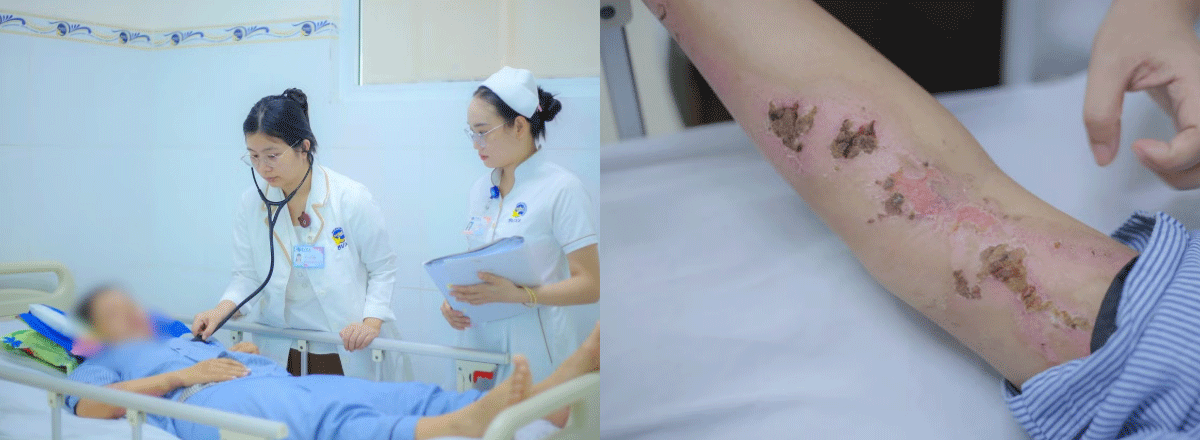 T&igrave;nh h&igrave;nh hiện tại của c&ocirc; g&aacute;i bị s&eacute;t đ&aacute;nh dẫn đến xuất huyết n&atilde;o? B&aacute;c sĩ chỉ c&aacute;ch tr&aacute;nh s&eacute;t khi trời gi&ocirc;ng