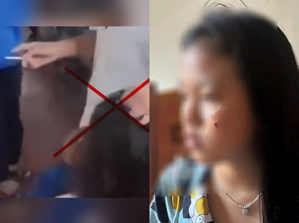 Vụ nữ sinh ở Đắk Lắk bị đ&aacute;nh, d&iacute; thuốc l&aacute; v&agrave;o mặt: Gia đ&igrave;nh tiết lộ t&igrave;nh trạng mới nhất