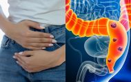Phát hiện nguyên nhân gây ra 1 căn bệnh ung thư đang gia tăng ở người trẻ