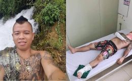 ‘Thánh chửi’ Dương Minh Tuyền nói rõ chuyện bị đánh nhập viện, cơ quan chức năng cũng lên tiếng