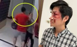 Luật sư tiết lộ mức án chủ chó hành hung người cha bảo vệ con khỏi chó thả rông có thể phải nhận