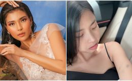 Thúy Diễm gặp sự cố tại phim trường dẫn đến bầm dập tay chân, sự thật gây bất ngờ