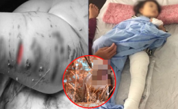 Loài vật nguy hiểm nhất thế giới, nhiều nước cấm nuôi nhưng Việt Nam ‘bất chấp’ dù đã cắn chết người