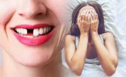 Tại sao chúng ta lại mơ bị rụng răng? Giải thích của giới khoa học khiến nhiều người ngỡ ngàng