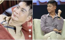 Ngoại hình lạ lẫm của đạo diễn Lê Hoàng sau khi động ‘dao kéo’, được so sánh với MC Thanh Bạch