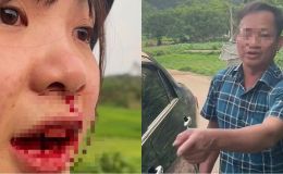 Rộ tin người chặn xe, đánh cô gái 23 tuổi ở Bắc Giang là cán bộ xã, lãnh đạo địa phương nói gì?