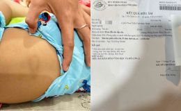 Thông tin sốc vụ bé gái 2 tuổi bị ‘chấn thương vùng kín’, cơ sở giữ trẻ tiết lộ tình tiết không ai nghĩ đến