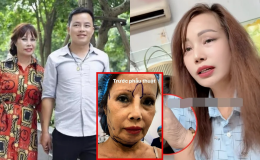 'Cô dâu Cao Bằng' lại 'dao kéo' để xứng với chồng kém 36 tuổi, ngoại hình hiện tại gây chấn động