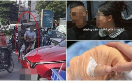 Vợ của Tiktoker Hà Lít có động thái khẩn giữa lúc chồng bị chém đứt gần lìa bàn tay