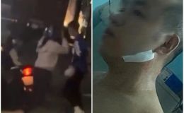 Hai vợ chồng công nhân bị đánh đập dã man giữa đường ở TPHCM: Bất ngờ trước mối quan hệ giữa đôi bên