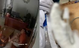 Sau Hà List, nạn nhân bị chém lìa tay ở Hải Phòng được nối lại thần kỳ: Hung thủ là ai?