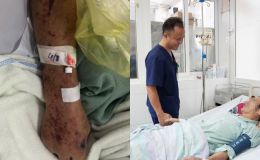 Người đàn ông Hưng Yên suýt tử vong sau khi chế biến thịt lợn sống: Bác sĩ cảnh báo hiểm họa từ liên cầu khuẩn lợn