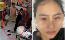 Nguyên nhân khó chấp chấp nhận vụ người phụ nữ bị nam chủ nhà đánh đập dã man tại quán ăn ở TPHCM