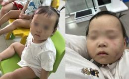 Tình hình sức khoẻ bé gái 1 tuổi tím tái mặt mũi sau buổi đầu đến lớp ở Bắc Ninh: Cơ quan chức năng nói gì?