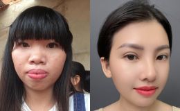 ‘Thị nở tái sinh’ Quách Phượng tiếp tục trùng tu nhan sắc, diện mạo mới thay đổi ngỡ ngàng