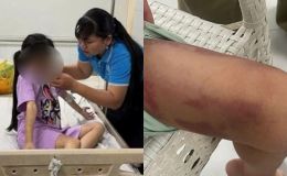 Tạm giữ mẹ ruột 25 tuổi và bạn trai 19 tuổi đánh đập cháu bé ở TP.HCM đến mức phải nhập viện