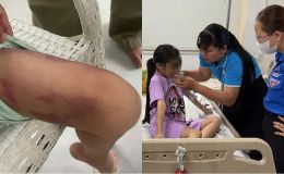 Thân thế gây phẫn nộ của 2 người vừa bị bắt vì bạo hành cháu bé 9 tuổi, bắt nhúng lưỡi vào nước sôi