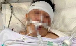 TPHCM: Tông trúng chó chạy rông, nam thanh niên nhập viện trong tình trạng 'ngàn cân treo sợi tóc'