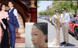 Sức khỏe người tiêu dùng bị đe dọa nghiêm trọng khi dùng mỹ phẩm rởm đột lốt cao cấp của Mailisa