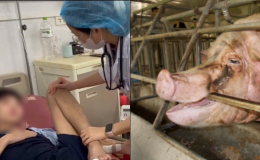 Tình hình sức khỏe của nam thiếu niên bị lợn cắn tại Sơn La sau 1 tháng điều trị 