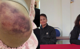 Lời kể xót xa của bà ngoại bé gái 14 tuổi bị nhà nội bạo hành dã man ở Thái Nguyên
