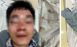 Vợ tài xế xe buýt bị đánh đến chấn thương sọ não ở Hà Nội tiết lộ thông tin quan trọng về hung thủ