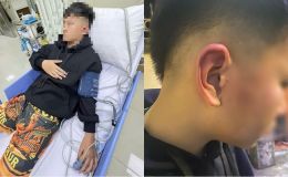 Công an vào cuộc vụ cháu bé bị bố của bạn học đánh khi đến nhà chơi, hé lộ nguồn cơn sự việc