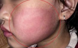 Bé gái 4 tuổi đứng nhảy trước nhà bất ngờ bị người lạ tát mạnh, camera tiết lộ tình tiết bất ngờ