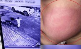 Thông tin mới vụ bé gái 4 tuổi bị người lạ tát: Gia đình lên tiếng đính chính