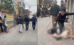 Nạn nhân vụ thả chó cắn người phải nhập viện chưa hết bàng hoàng kể chi tiết vụ việc, hé lộ nguồn cơn 