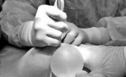 Tiêm filler nâng ngực, người phụ nữ 30 tuổi nhập viện vì hoại tử nặng, bác sĩ cảnh báo nguy hiểm từ làm đẹp giá rẻ