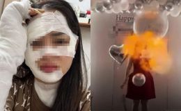 Tình trạng sức khỏe và diện mạo hiện tại của cô gái bị bỏng nặng do bóng bay sinh nhật phát nổ