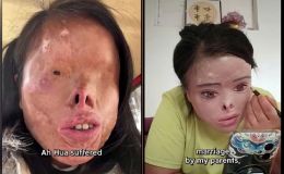 Bị chồng cũ tạt axit mù mắt: Người phụ nữ gây sốc khi tự ‘vẽ’ lại dung nhan để đổi đời
