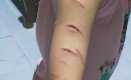 Xót xa vụ bé gái 12 tuổi bị chị họ rạch nát tay: Hiện trường phòng ngủ hé lộ sự thật ám ảnh