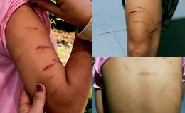 Nguyên nhân khiến bé gái lớp 5 bị rạch 200 nhát trên người ở Cà Mau: Liên quan đến dì ruột nạn nhân
