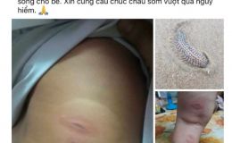 Sự thật không ngờ đằng sau màn kịch kêu gọi cứu trợ máu khẩn cấp cho cháu bé 3 tuổi bị sâu biển cắn