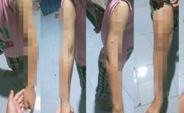 Phát hiện đáng sợ trong phòng ngủ bé gái lớp 5 bị chị họ dùng dao rạch toàn thân, xót xa hoàn cảnh nạn nhân